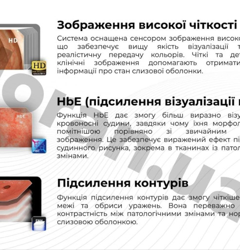 Купити ендоскопічну стійку для гастроскопії, колоноскопії та бронхоскопії